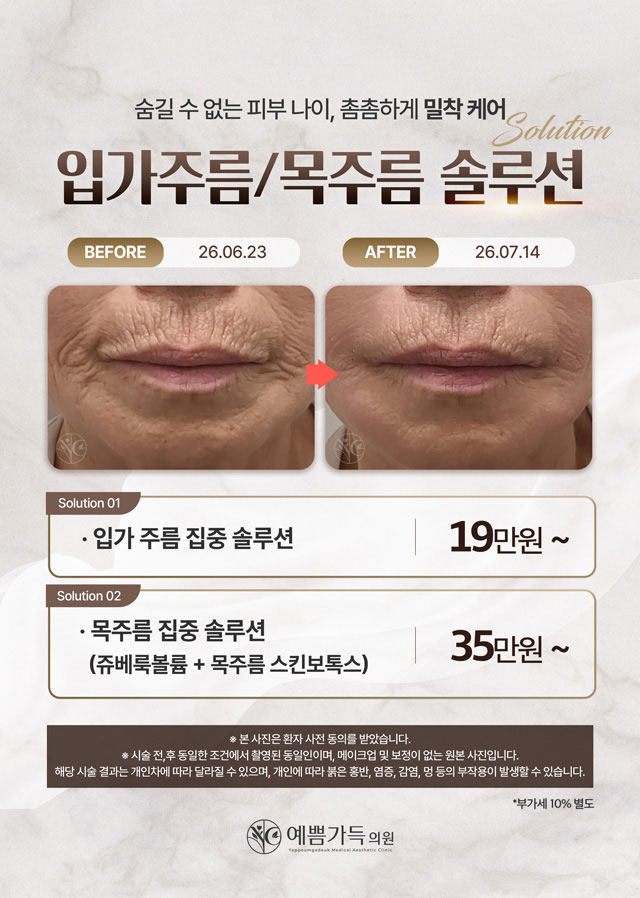 입가주름 목주름