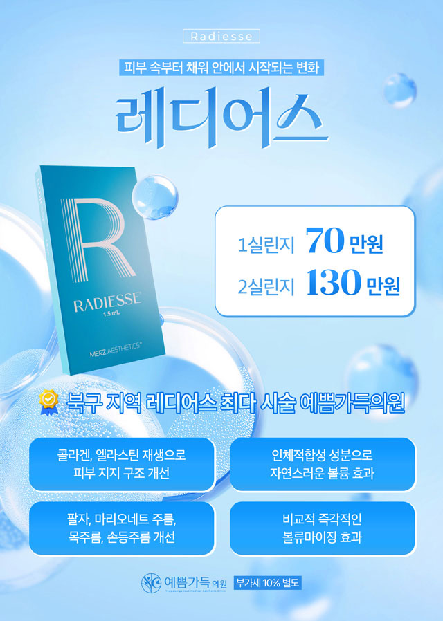 레디어스