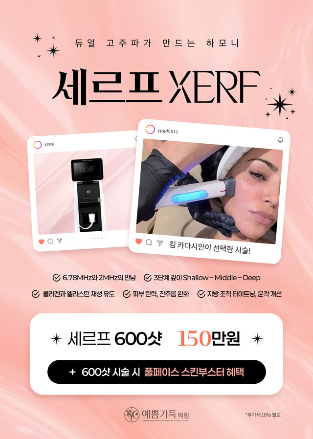 세르프